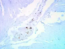 Anti-p27 Kip1 antibody used in IHC (Paraffin sections) (IHC-P). GTX100446